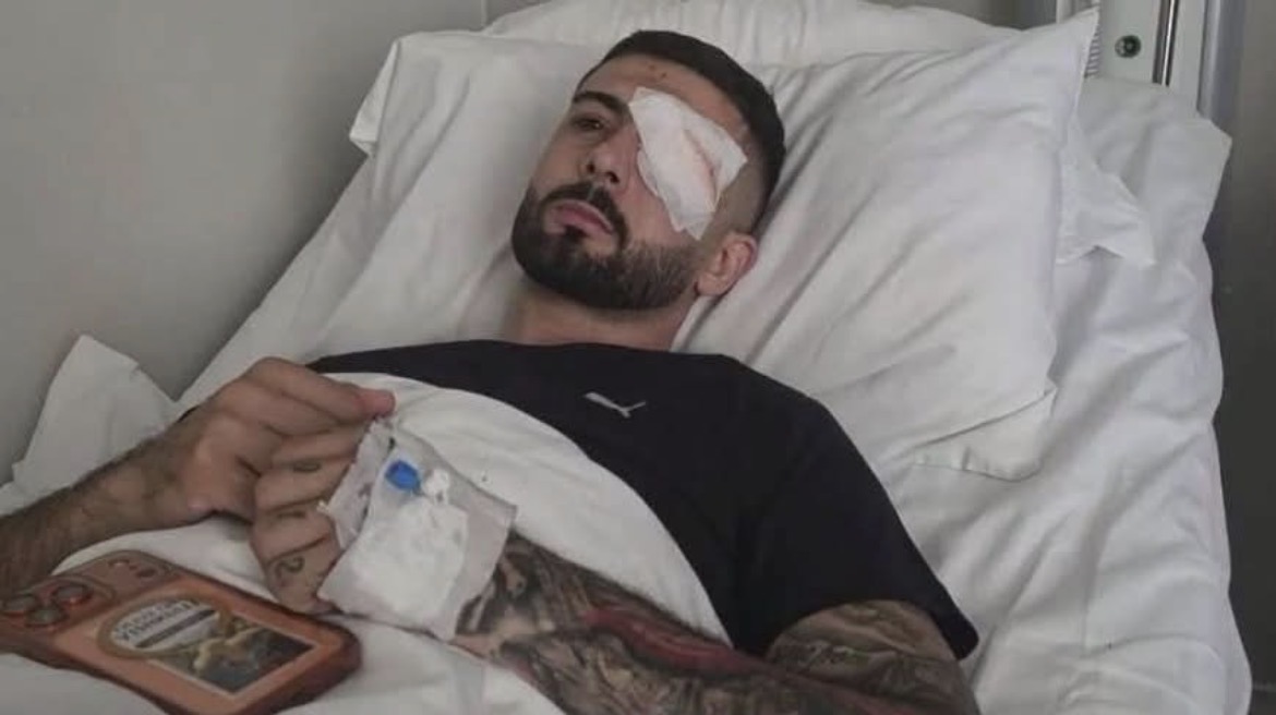 “Eca dy hapa dhe rashë në tokë”, plagoset rëndë protestuesi nga plumbi i gomës